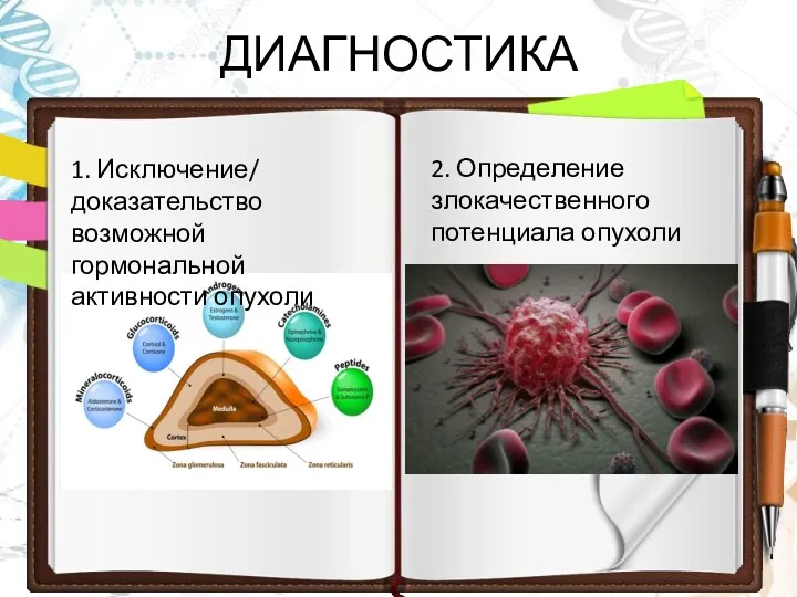 ДИАГНОСТИКА 1. Исключение/ доказательство возможной гормональной активности опухоли 2. Определение злокачественного потенциала опухоли