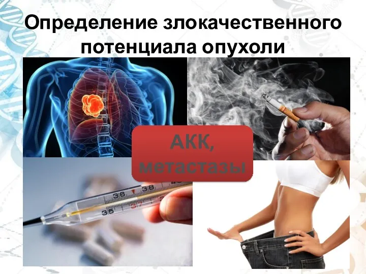 Определение злокачественного потенциала опухоли АКК, метастазы