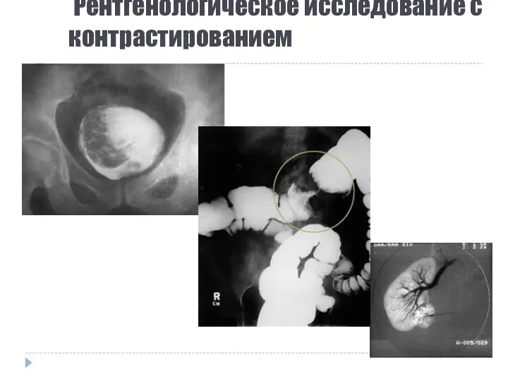 Рентгенологическое исследование с контрастированием