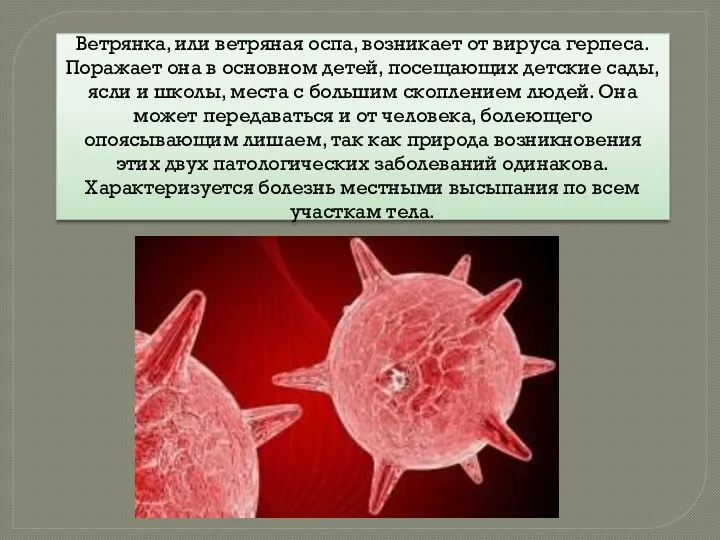 Ветрянка, или ветряная оспа, возникает от вируса герпеса. Поражает она в основном детей,