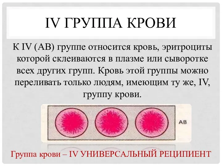 IV ГРУППА КРОВИ К IV (АВ) группе относится кровь, эритроциты