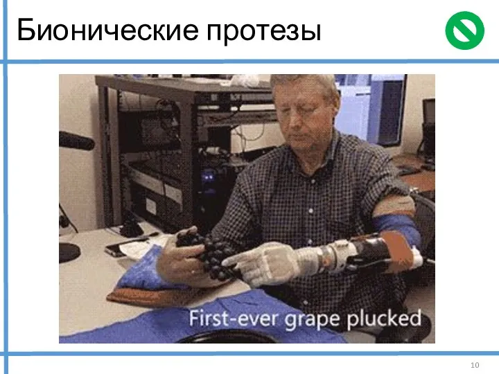 Бионические протезы