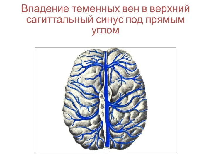 Впадение теменных вен в верхний сагиттальный синус под прямым углом