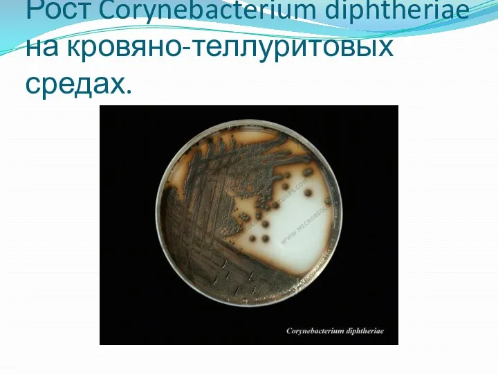 Рост Corynebacterium diphtheriae на кровяно-теллуритовых средах.