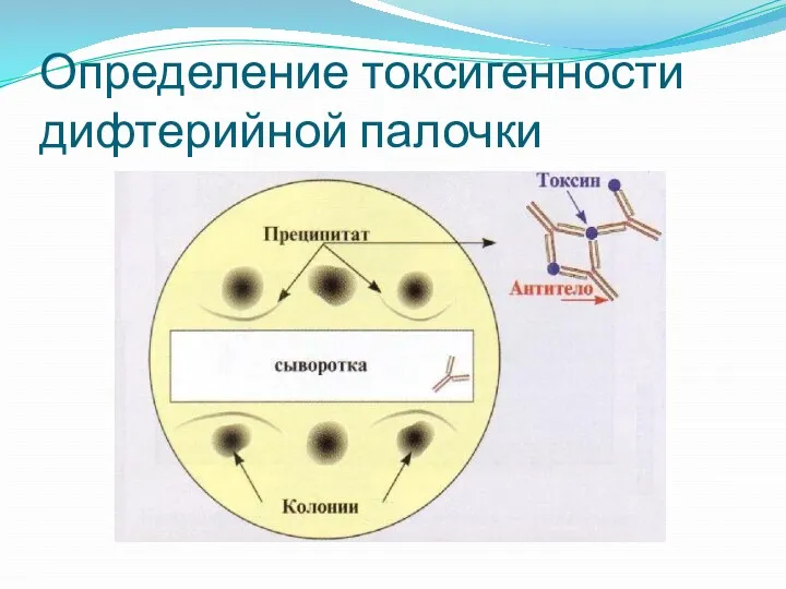 Определение токсигенности дифтерийной палочки