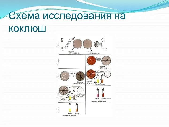 Схема исследования на коклюш