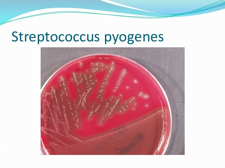 Streptococcus pyogenes