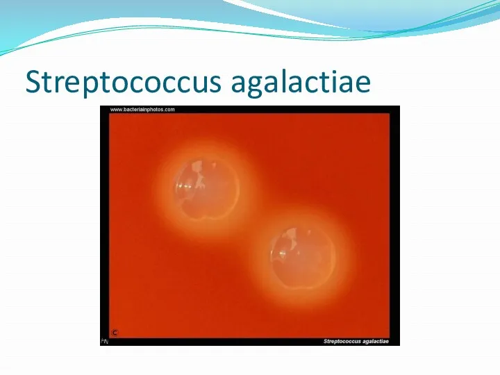 Streptococcus agalactiae