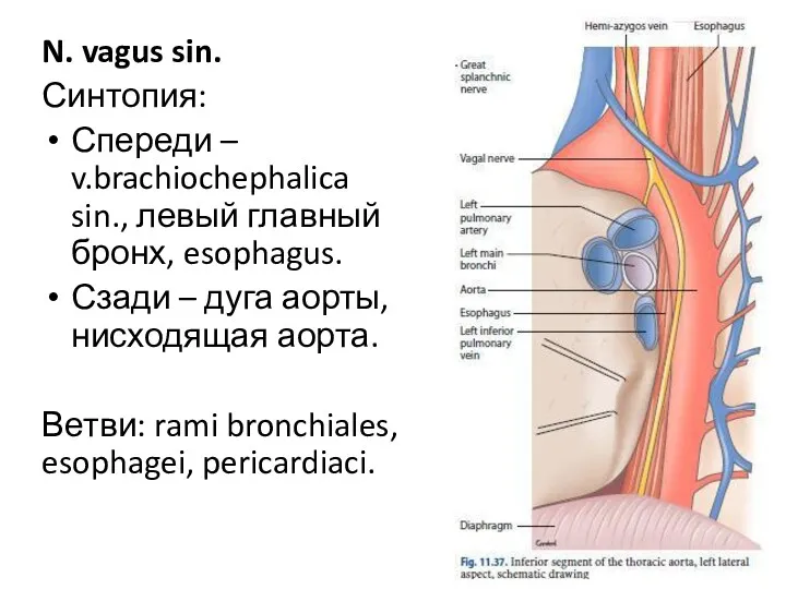 N. vagus sin. Синтопия: Спереди – v.brachiochephalica sin., левый главный