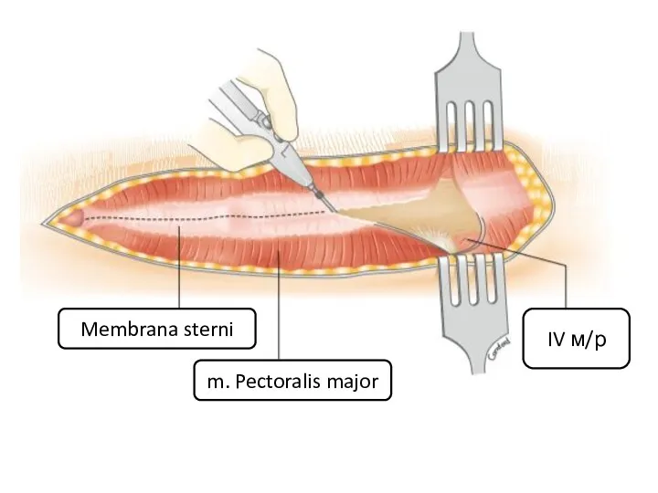 Membrana sterni m. Pectoralis major IV м/р