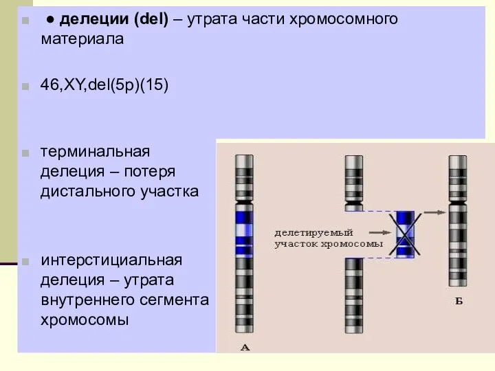 ● делеции (del) – утрата части хромосомного материала 46,XY,del(5p)(15) терминальная