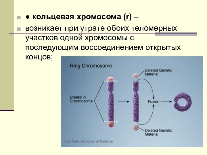 ● кольцевая хромосома (r) – возникает при утрате обоих теломерных