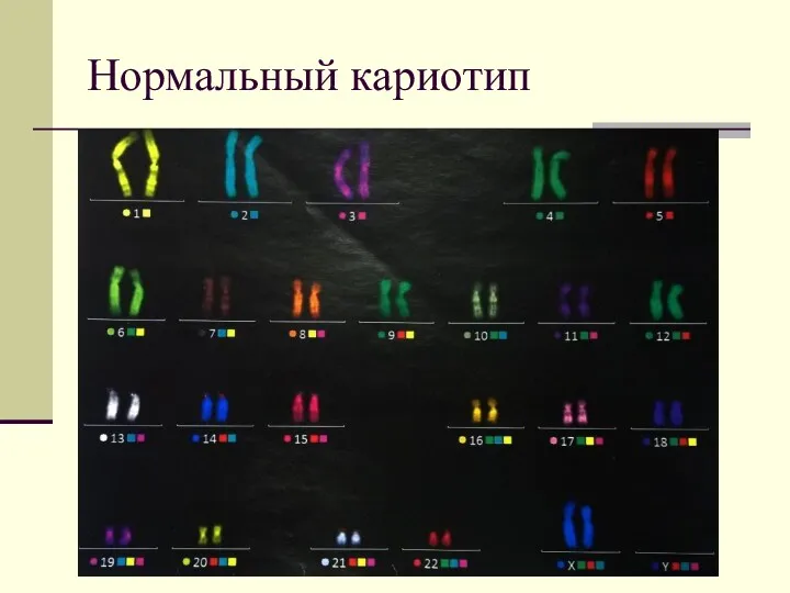 Нормальный кариотип