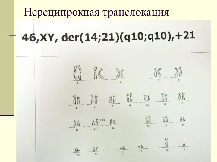 Нереципрокная транслокация