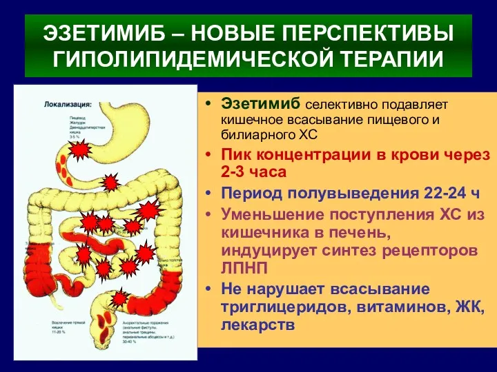 ЭЗЕТИМИБ – НОВЫЕ ПЕРСПЕКТИВЫ ГИПОЛИПИДЕМИЧЕСКОЙ ТЕРАПИИ Эзетимиб селективно подавляет кишечное всасывание пищевого и