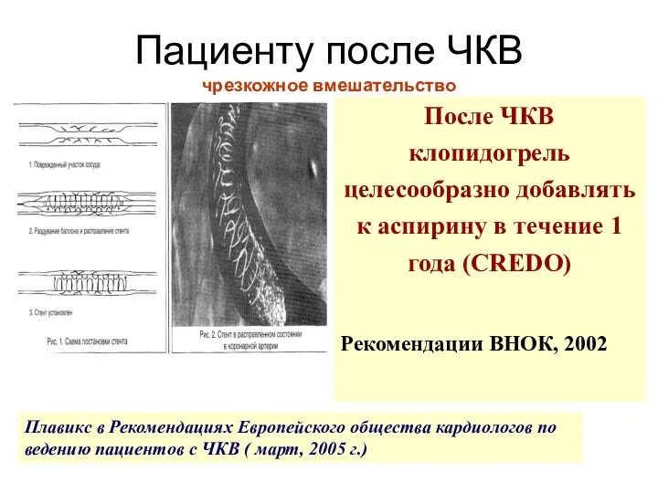 Пациенту после ЧКВ чрезкожное вмешательство После ЧКВ клопидогрель целесообразно добавлять к аспирину в