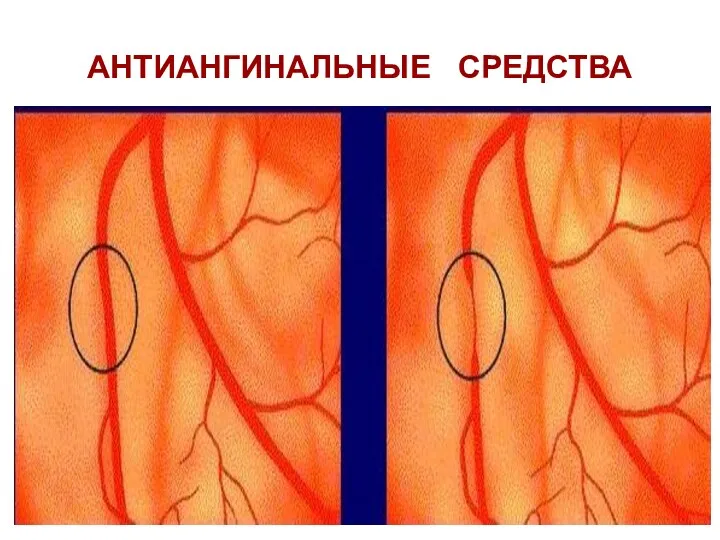 АНТИАНГИНАЛЬНЫЕ СРЕДСТВА БЕТА-АДРЕНОБЛОКАТОРЫ АНТАГОНИСТЫ Са2+ пролонгированные НИТРАТЫ И НИТРОПОДОБНЫЕ ПРЕПАРАТЫ,