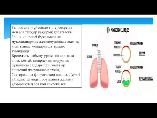 Тыныс алу жүйесінде гиперсекреция мен аса тұтқыр қақырық қабаттасуы бронх