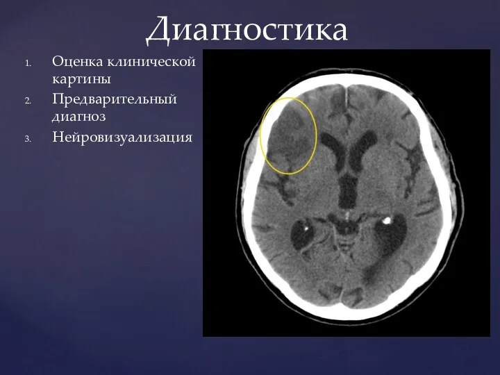 Оценка клинической картины Предварительный диагноз Нейровизуализация Диагностика