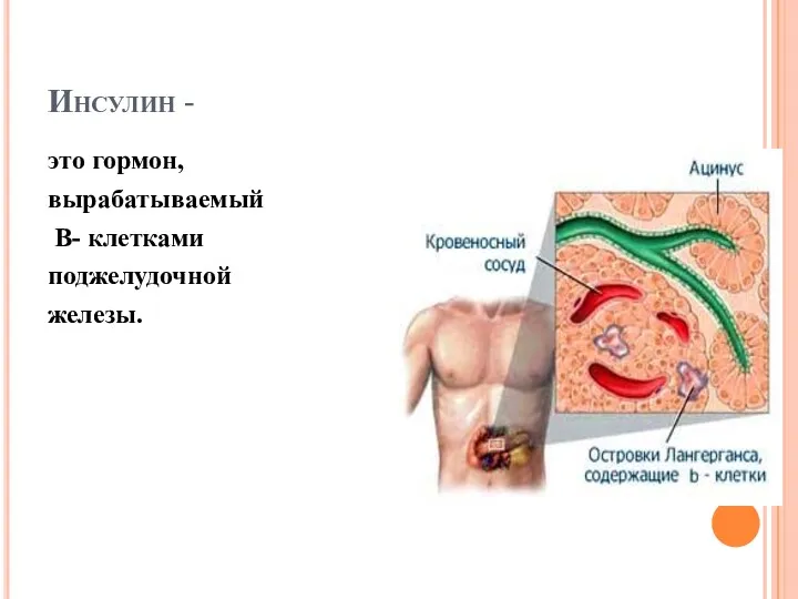 Инсулин - это гормон, вырабатываемый В- клетками поджелудочной железы.