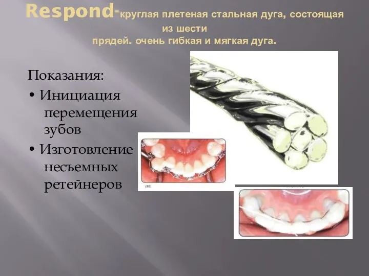 Respond-круглая плетеная стальная дуга, состоящая из шести прядей. очень гибкая