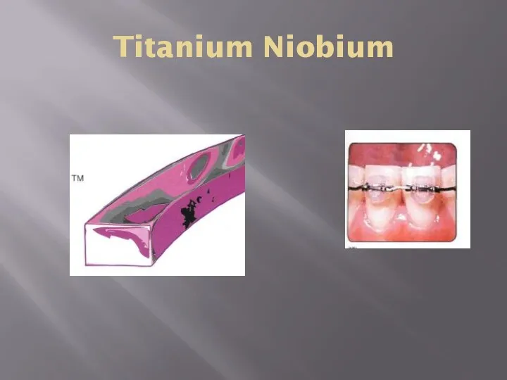 Titanium Niobium