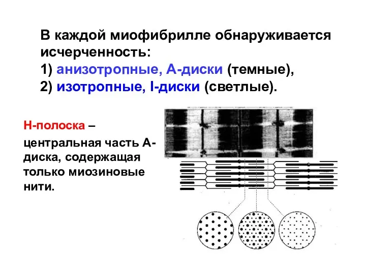 В каждой миофибрилле обнаруживается исчерченность: 1) анизотропные, А-диски (темные), 2)