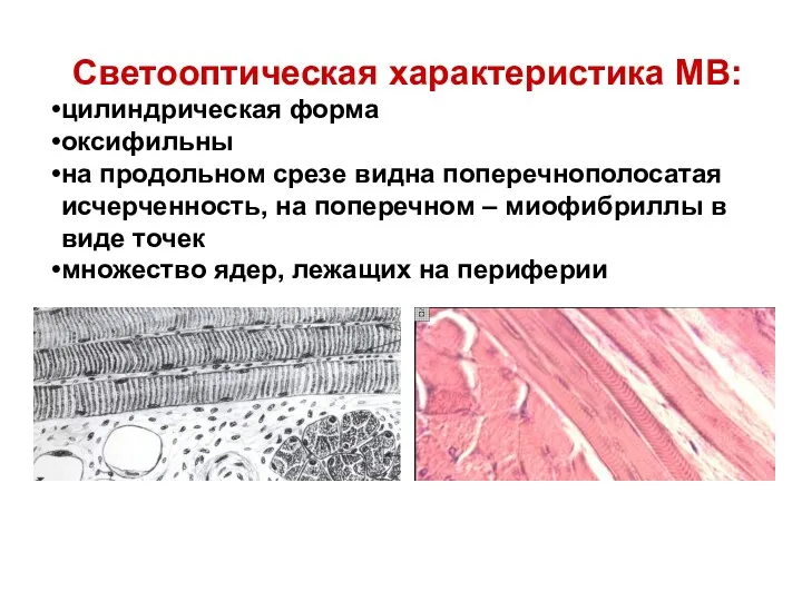 Светооптическая характеристика МВ: цилиндрическая форма оксифильны на продольном срезе видна