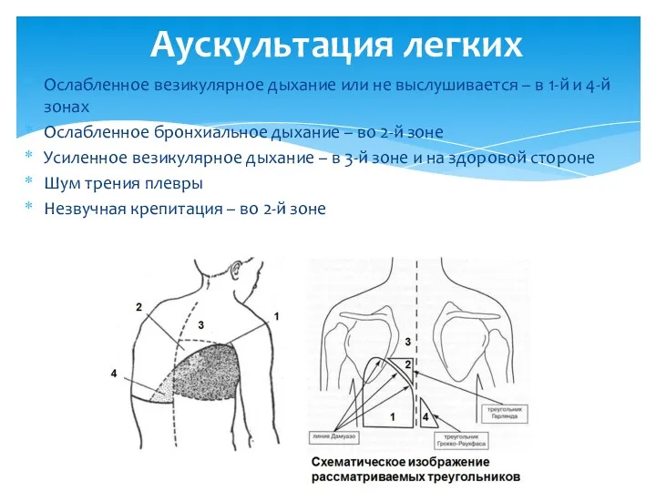 Ослабленное везикулярное дыхание или не выслушивается – в 1-й и