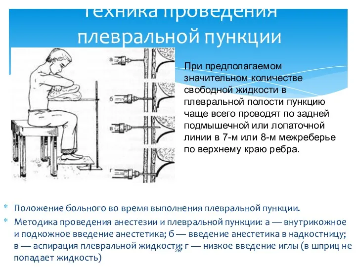 Положение больного во время выполнения плевральной пункции. Методика проведения анестезии