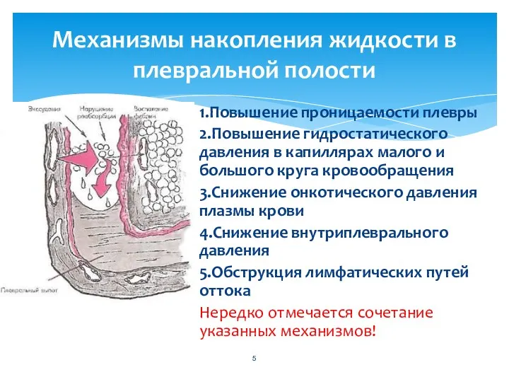 1.Повышение проницаемости плевры 2.Повышение гидростатического давления в капиллярах малого и