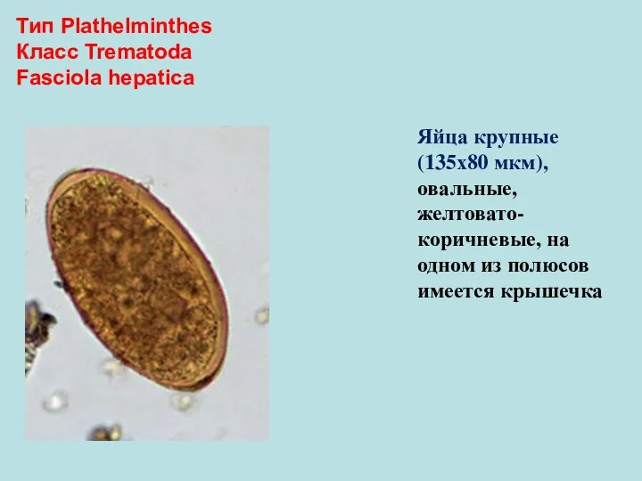 Тип Plathelminthes Класс Trematoda Fasciola hepatica Яйца крупные (135х80 мкм),