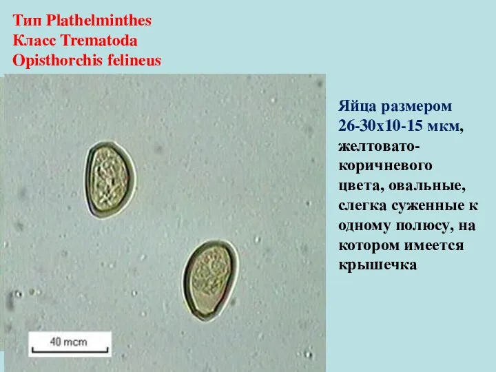 Тип Plathelminthes Класс Trematoda Opisthorchis felineus Яйца размером 26-30х10-15 мкм,