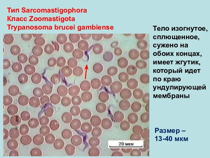 Тип Sarcomastigophora Класс Zoomastigota Trypanosoma brucei gambiense Тело изогнутое, сплющенное,