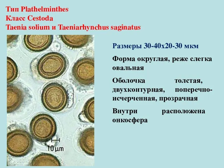 Размеры 30-40х20-30 мкм Форма округлая, реже слегка овальная Оболочка толстая,