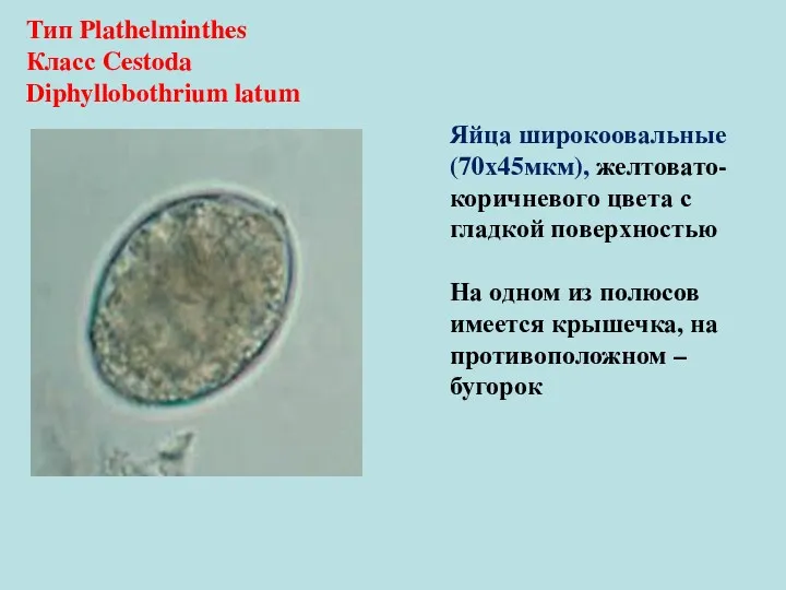 Тип Plathelminthes Класс Cestoda Diphyllobothrium latum Яйца широкоовальные (70х45мкм), желтовато-коричневого