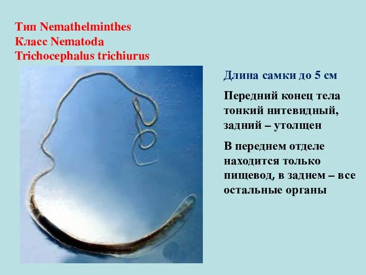 Тип Nemathelminthes Класс Nematoda Trichocephalus trichiurus Длина самки до 5