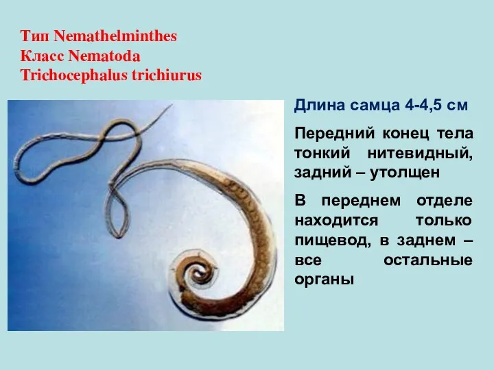 Тип Nemathelminthes Класс Nematoda Trichocephalus trichiurus Длина самца 4-4,5 см