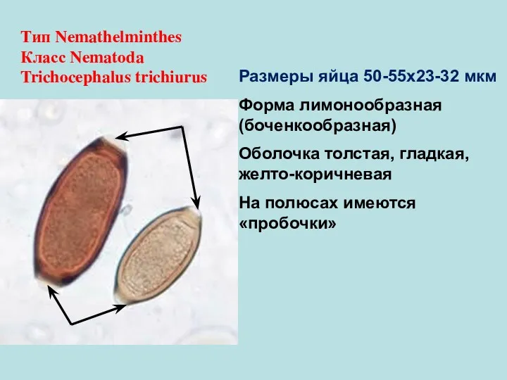 Тип Nemathelminthes Класс Nematoda Trichocephalus trichiurus Размеры яйца 50-55х23-32 мкм