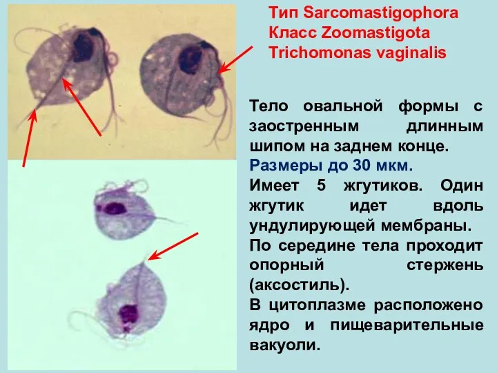 Тип Sarcomastigophora Класс Zoomastigota Trichomonas vaginalis Тело овальной формы с