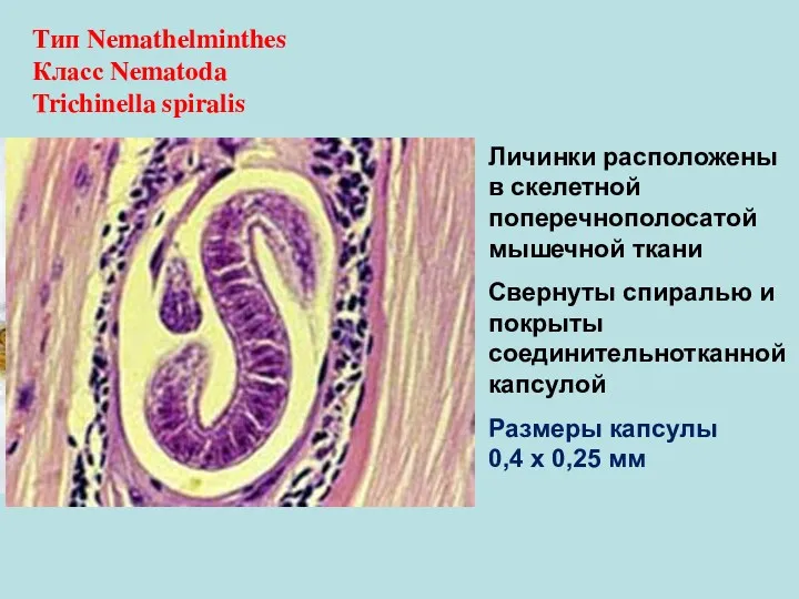 Тип Nemathelminthes Класс Nematoda Trichinella spiralis Личинки расположены в скелетной