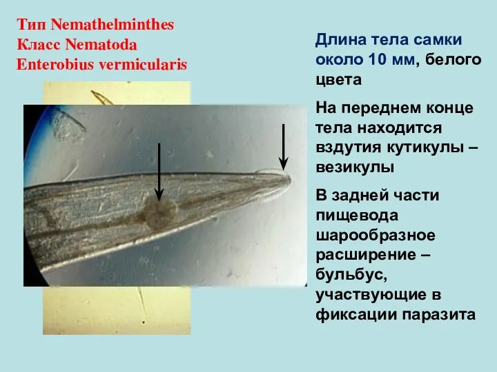 Тип Nemathelminthes Класс Nematoda Enterobius vermicularis Длина тела самки около