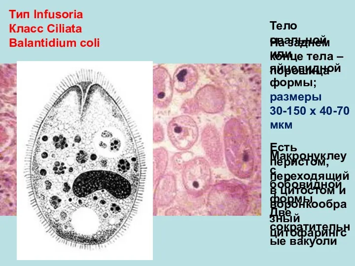 Тип Infusoria Класс Ciliata Balantidium coli Тело овальной или яйцевидной