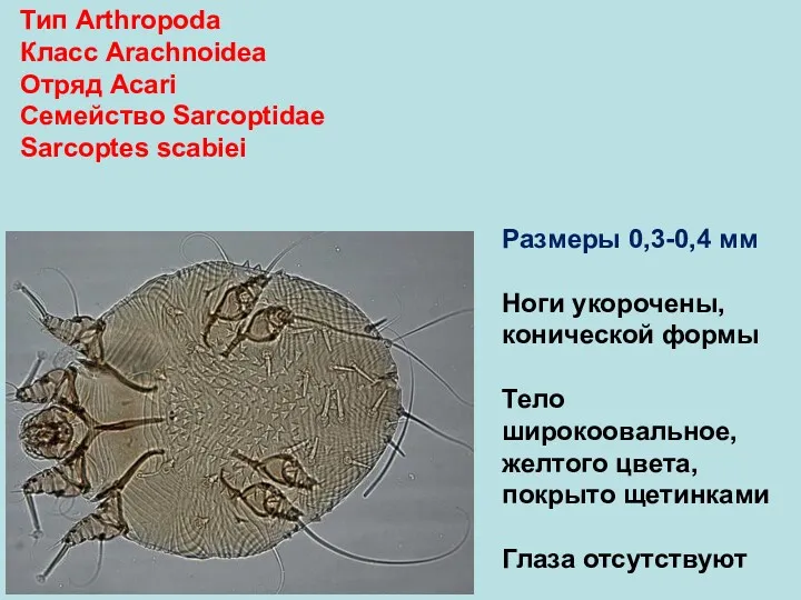 Тип Arthropoda Класс Arachnoidea Отряд Аcari Семейство Sarcoptidae Sarcoptes scabiei