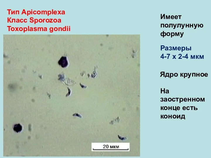 Тип Аpicomplexa Класс Sporozoa Toxoplasma gondii Имеет полулунную форму Размеры