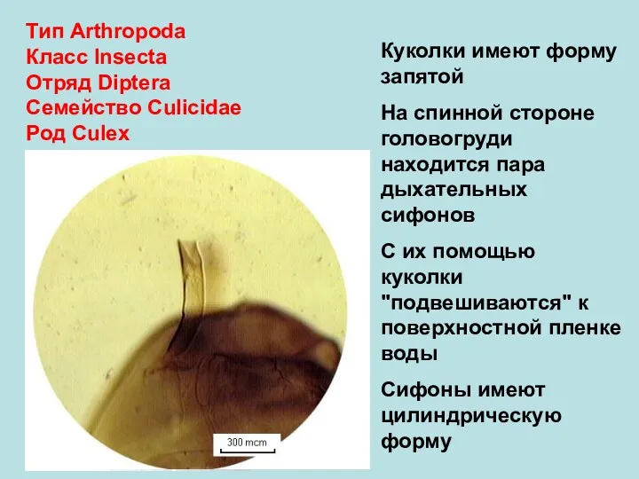 Тип Arthropoda Класс Insecta Отряд Diptera Семейство Culicidae Род Culex