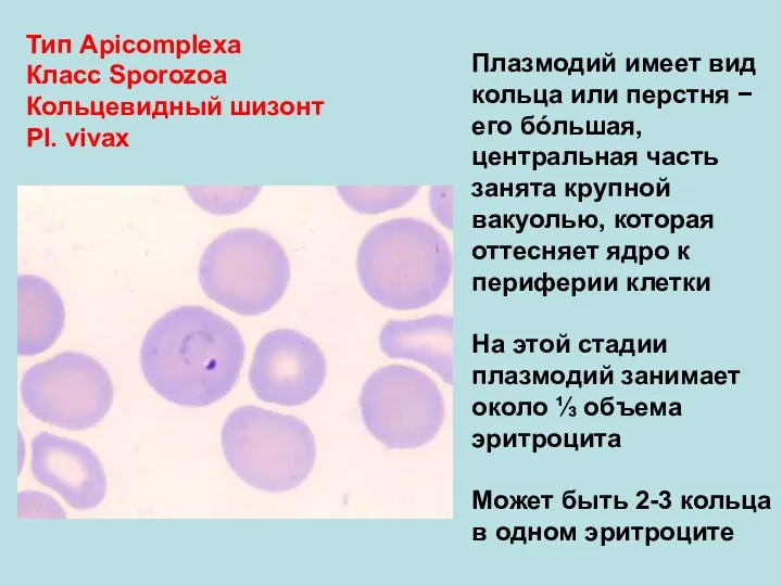 Тип Аpicomplexa Класс Sporozoa Кольцевидный шизонт Pl. vivax Плазмодий имеет