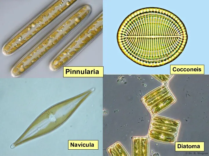 Pinnularia Navicula Cocconeis Diatoma