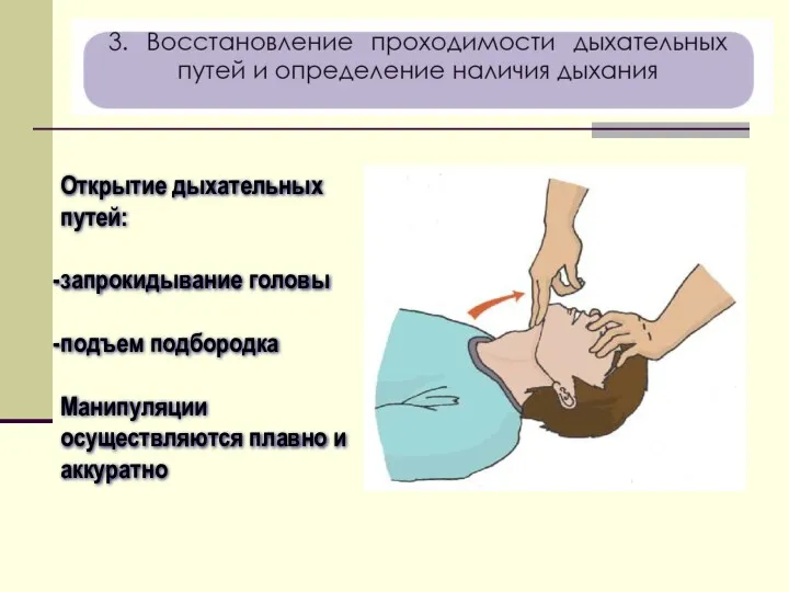 Открытие дыхательных путей: запрокидывание головы подъем подбородка Манипуляции осуществляются плавно и аккуратно