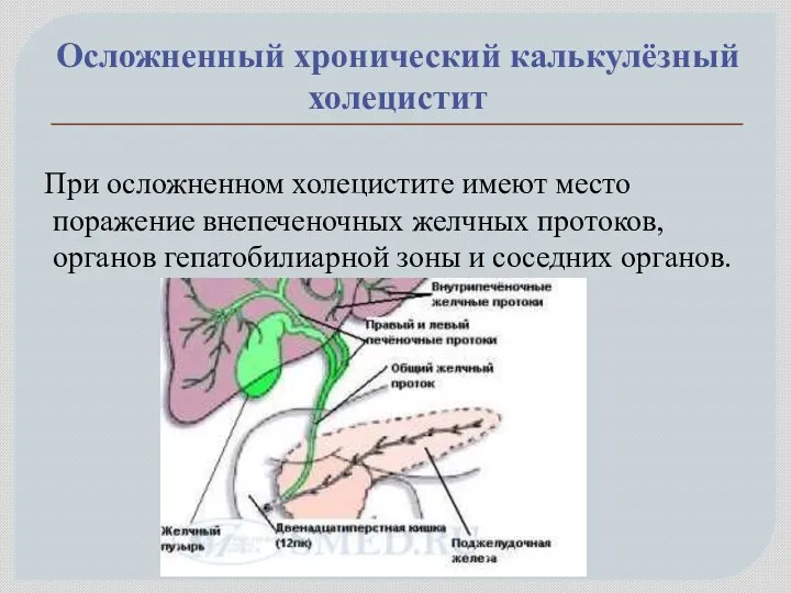 Осложненный хронический калькулёзный холецистит При осложненном холецистите имеют место поражение